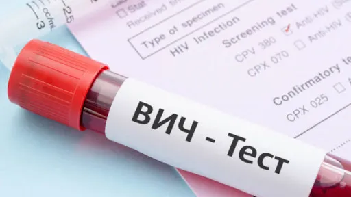 На Гомельщине за январь-март заболеваемость ВИЧ увеличилась на 30%